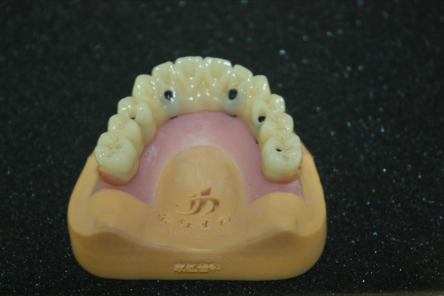 数字化种植临时修复体在美学区种植修复中的应用-瑞佳义齿